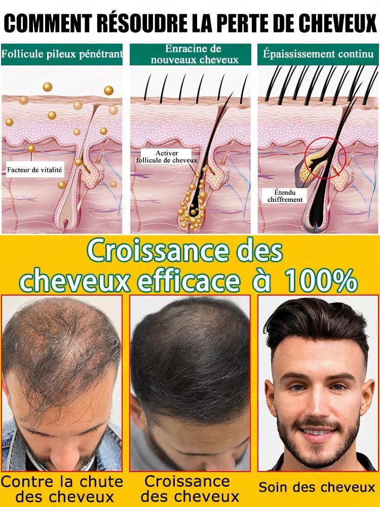 Ingredientes vegetales suaves  - Hair Care Natural Ingredients reseña y precio